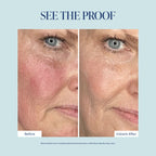 Before and after comparison of a woman's cheek showing skin improvement, with the text 'SEE THE PROOF' at the top and 'Before' and 'Instant After' labels below the split photo.