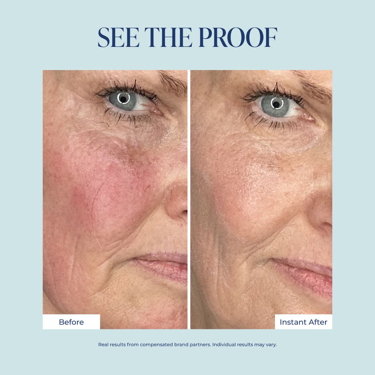 Before and after comparison of a woman's cheek showing skin improvement, with the text 'SEE THE PROOF' at the top and 'Before' and 'Instant After' labels below the split photo.