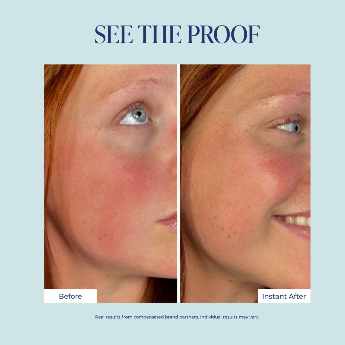 Before and after facial skin comparison of a woman with red hair, showing skin improvement on her cheek, under the text 'SEE THE PROOF' on a light blue background.